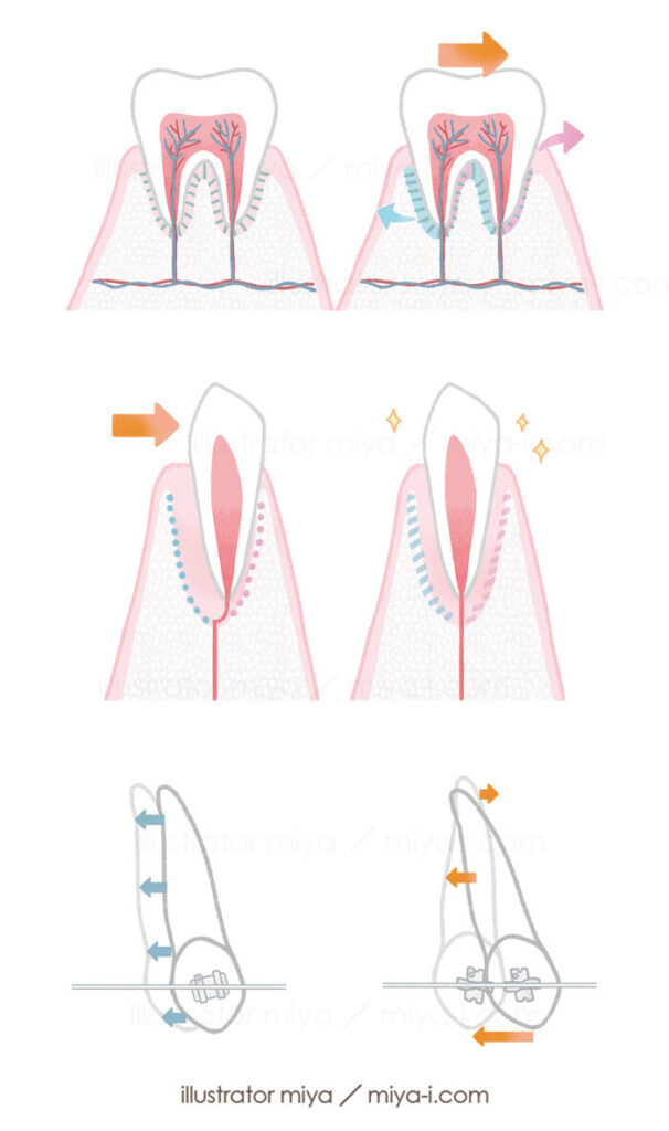 矯正イラスト・歯科・歯イラスト・矯正システム・歯列矯正・歯科医