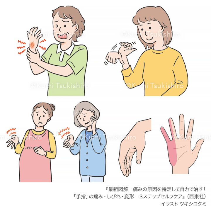 書籍『最新図解 原因を特定して自力で治す！ 「手指」の痛み・しびれ・変形 3ステップセルフケア』（西東社）本文イラスト