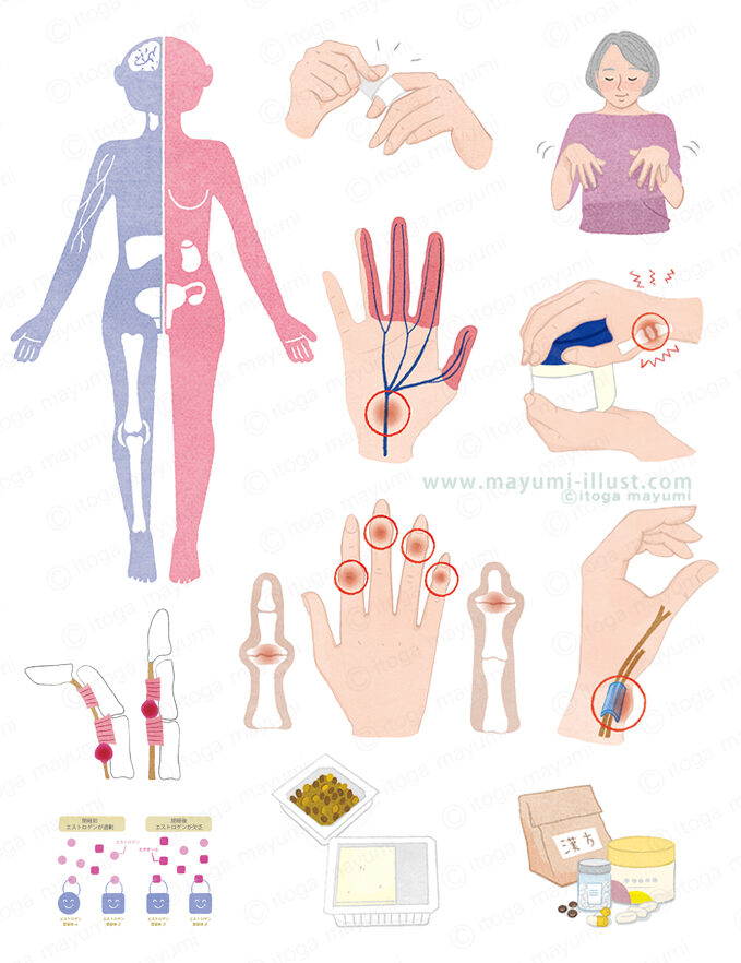 手指のトラブルのイラスト/宝島社「素敵なあの人12月号」