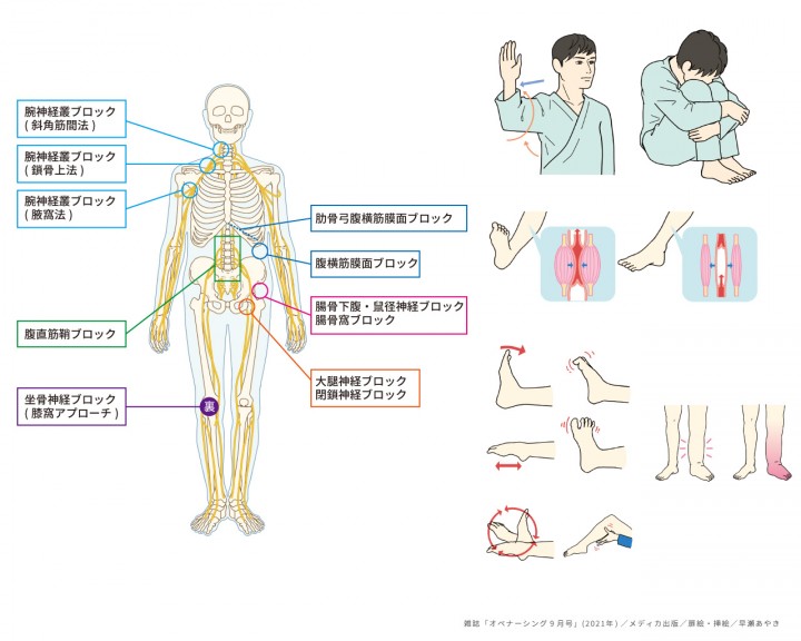 〈実績〉看護雑誌「オペナーシング9月号」挿絵