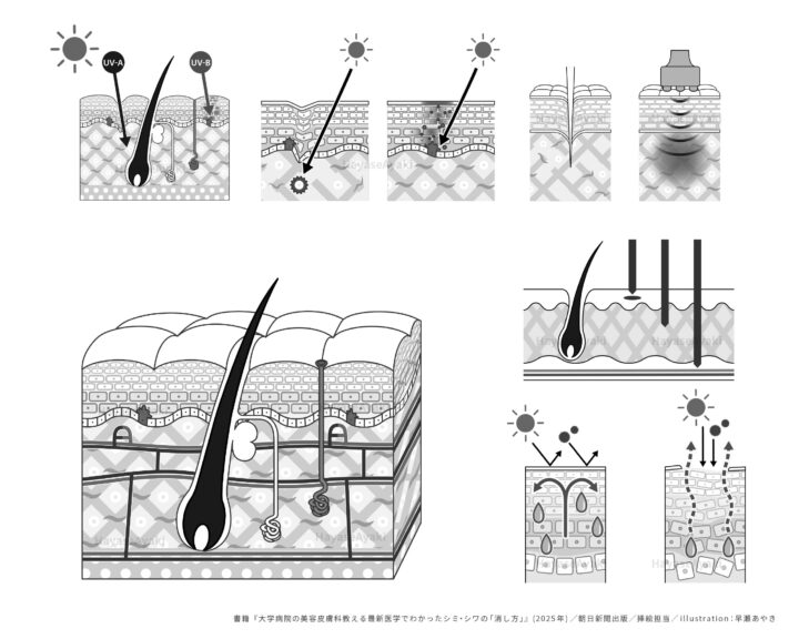 〈挿絵〉書籍「大学病院の美容皮膚科医が教える最新医学でわかったシミ・シワの消し方」