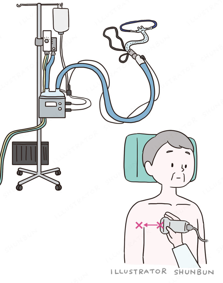 【お仕事】 みんなの呼吸器 Respica（レスピカ） 2025年6号 （メディカ出版）イラスト